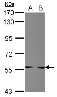 PPAT Antibody