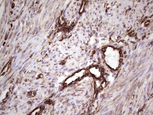 Peripherin Antibody (clone OTI1E10)
