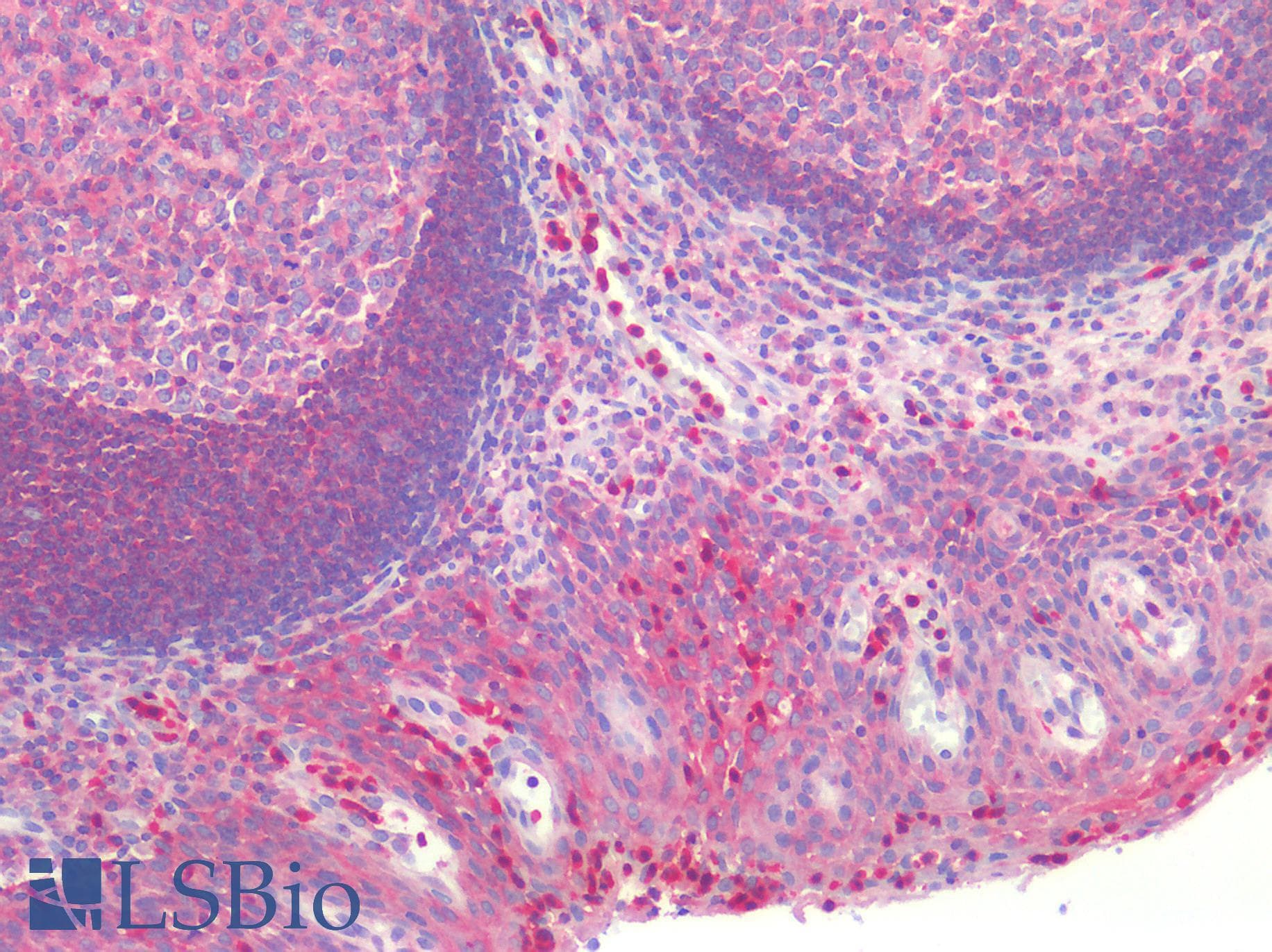 IHC-plus™ Monoclonal Mouse anti-Human G6PD Antibody (clone 2H7, IHC, WB)
