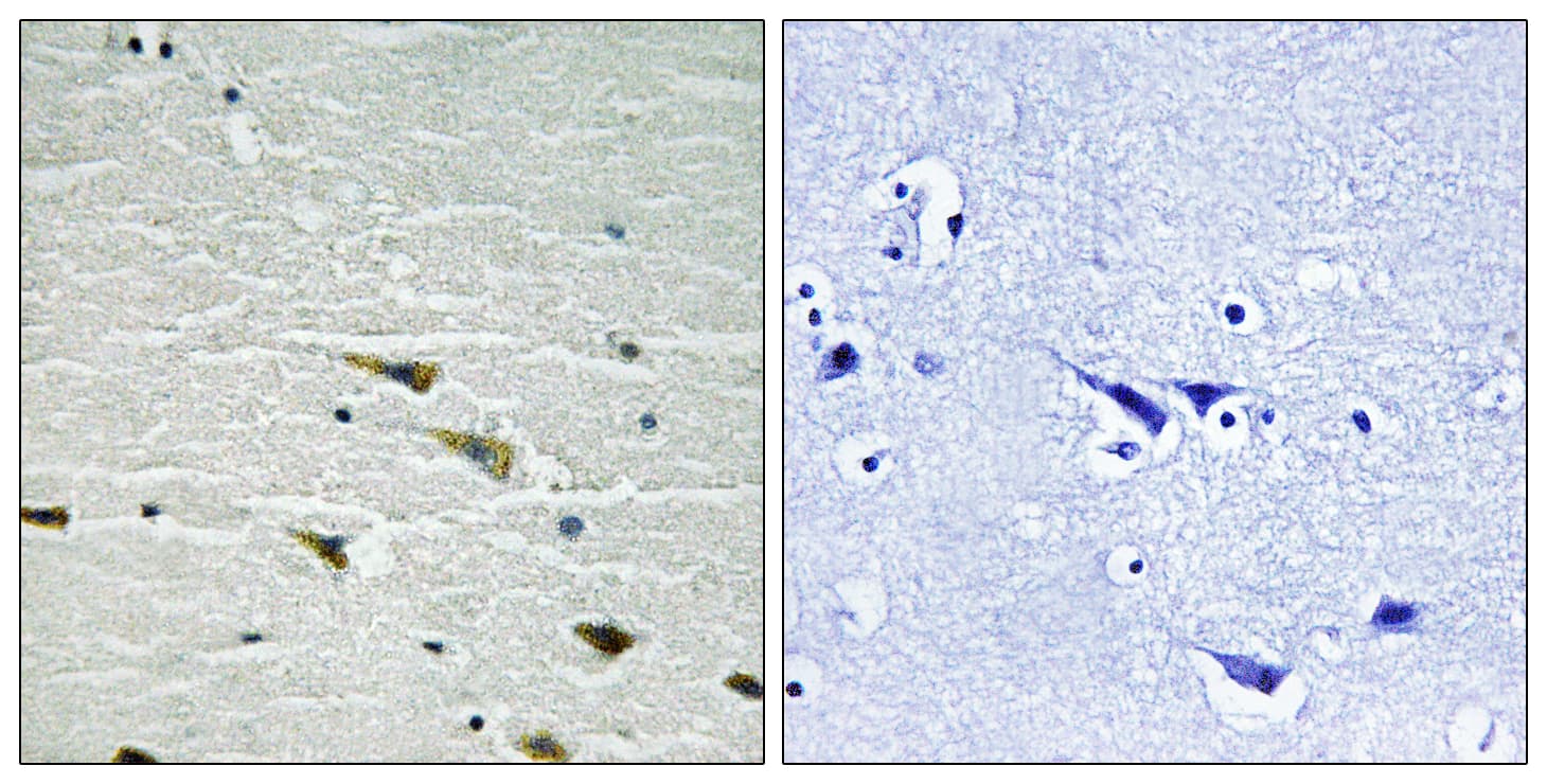 NTRK1 / TrkA Antibody (phospho-Tyr757)
