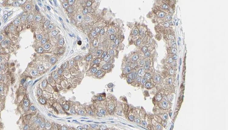 ADCY7 / Adenylate Cyclase 7 Antibody