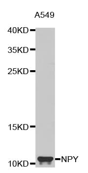Polyclonal Rabbit anti-Human Neuropeptide Y / NPY Antibody (IHC, WB)
