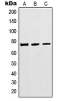 MTHFR Antibody (Internal)