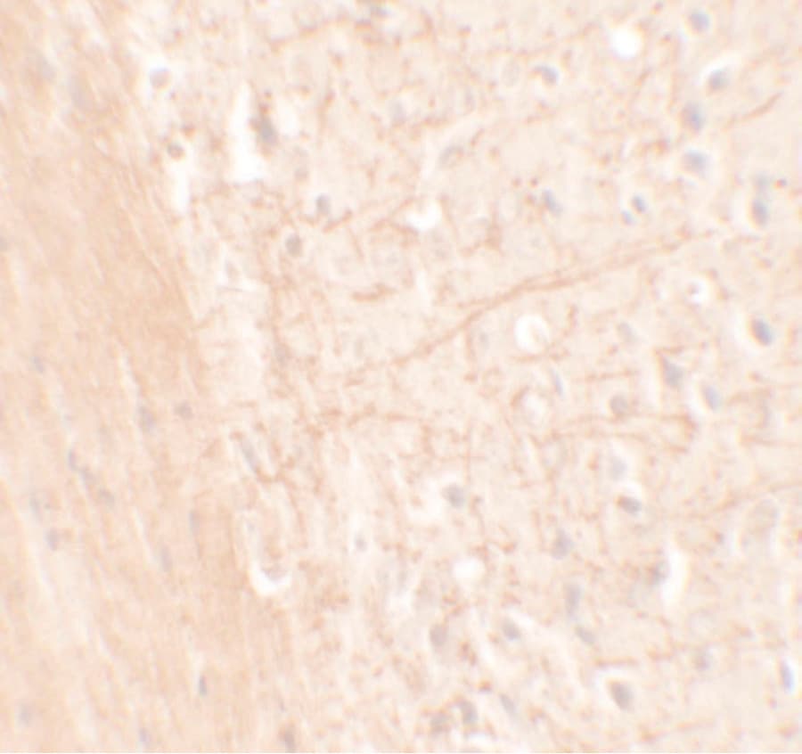 ARTS1 / ERAP1 Antibody