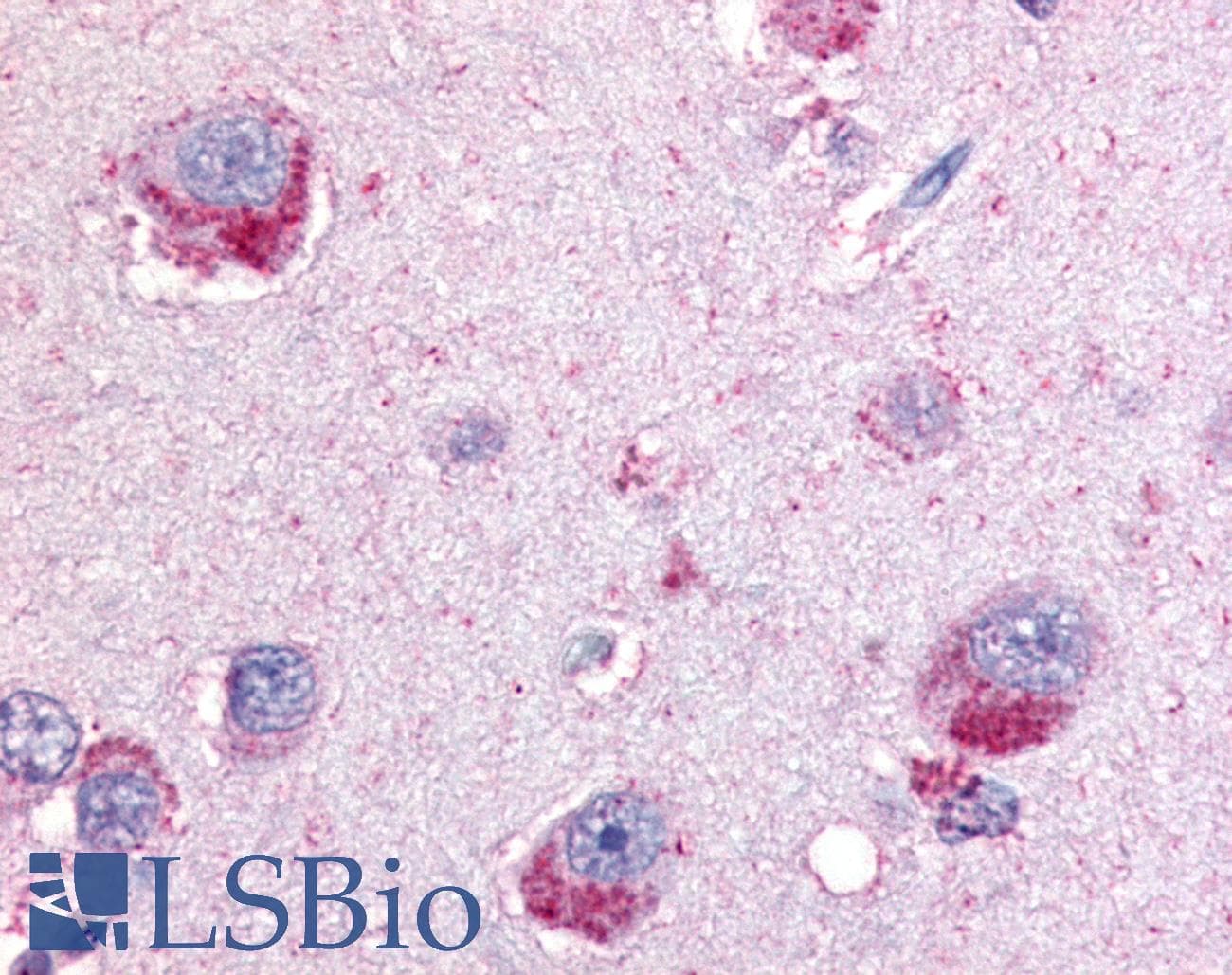 IHC-plus™ Polyclonal Rabbit anti-Human GPBB / PYGB Antibody (Internal, IHC)
