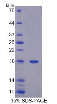 Human C2orf40 / ECRG4 Protein (Recombinant His, N-terminus)