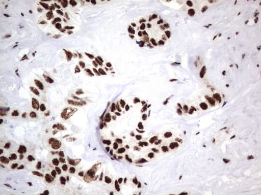 DDX56 Antibody (aa323-547, clone UMAB153, Carrier-free)