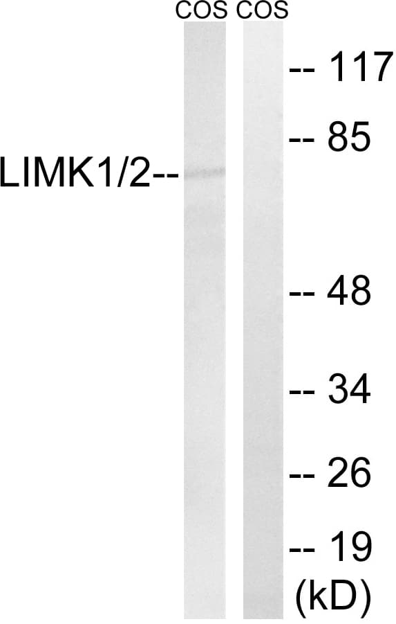 LIMK1 + LIMK2 Antibody (aa481-530)