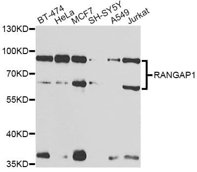 RANGAP1 Antibody