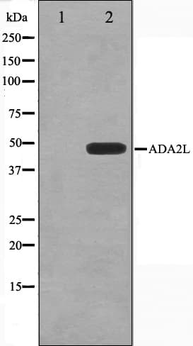 TADA2L / ADA2A Antibody