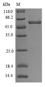 Human TRAIP / TRIP Protein (Recombinant 6His, N-terminus)