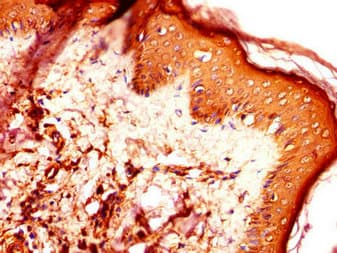 DNAJC6 Antibody
