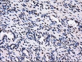 Monoclonal Mouse anti-Human GBE1 Antibody (clone OTI1D11, IHC, IF, WB)