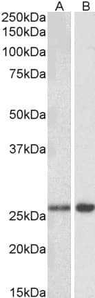 IHC-plus™ MOB4 / PHOCN Antibody (aa116-130)