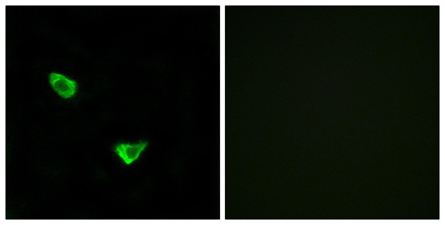 CHPF / CHSY2 Antibody