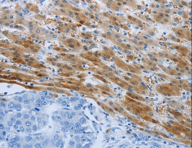 PSMD11 Antibody