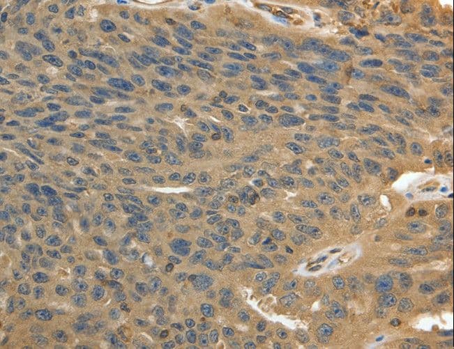 MSN / Moesin Antibody
