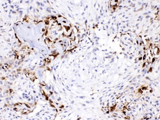 Polyclonal Rabbit anti-Human CA3 / Carbonic Anhydrase III Antibody (IHC, WB)