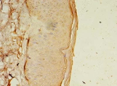 OSR2 Antibody