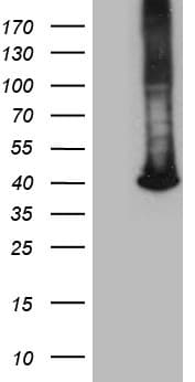 GALM / Mutarotase Antibody (clone OTI4F4)