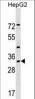 LZTFL1 Antibody (aa4-30)