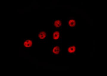 Polyclonal Rabbit anti-Human RELA / NFKB p65 Antibody (IHC, IF, WB)