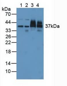PSMD7 / MOV34 Antibody (aa1-324)