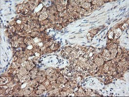 MAP2K1 / MKK1 / MEK1 Antibody (clone OTI8A6, Carrier-free)