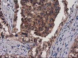 DSTN / Destrin Antibody (clone OTI1D8)