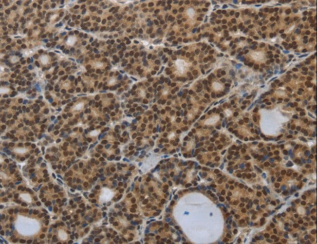SMAD7 Antibody