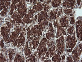 Monoclonal Mouse anti-Human TRIM44 Antibody (clone OTI1E10, IHC, IF, WB)