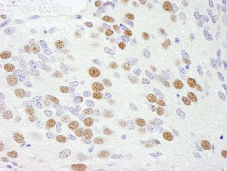 RBFOX2 / RBM9 Antibody (aa1-50)