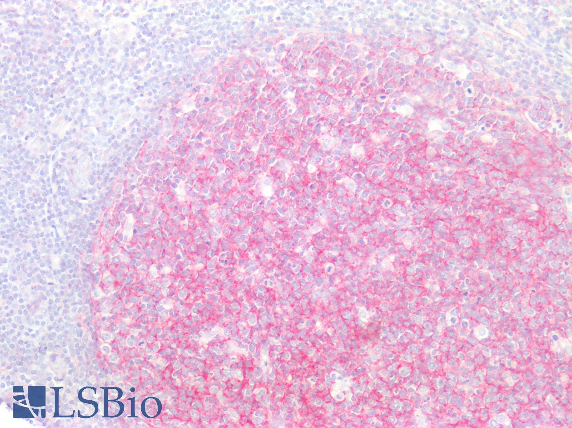 PathPlus™ Monoclonal Mouse anti-Human CD81 Antibody (clone 1.3.3.22, IHC, WB)