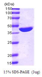E. coli MBP / Maltose Binding Protein (Recombinant)