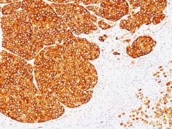 Monoclonal Mouse anti-Human Tyrosinase Antibody (clone SPM360, IHC, IF)