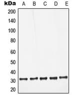 Polyclonal Rabbit anti-Human LGALS3 / Galectin 3 Antibody (Internal, IHC, IF, WB)