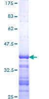 Human CARMA1 / CARD11 Protein (Recombinant GST, N-terminus)