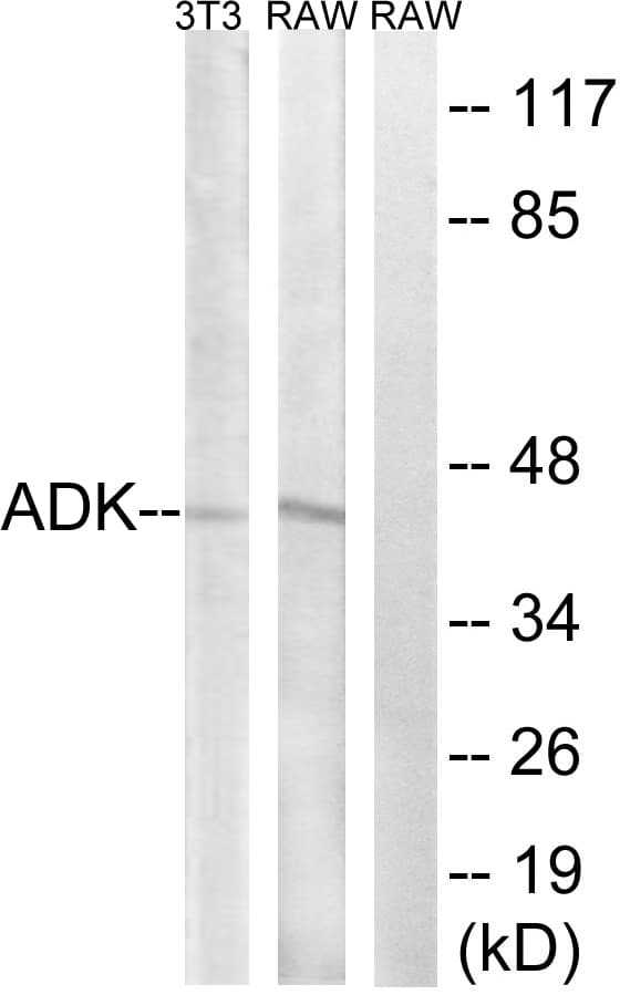 ADK / Adenosine Kinase Antibody (aa1-50)
