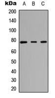 TNNI3K / CARK Antibody (Internal)