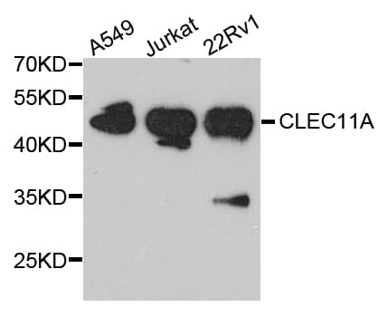 Polyclonal Rabbit anti-Human SCGF Antibody (WB)