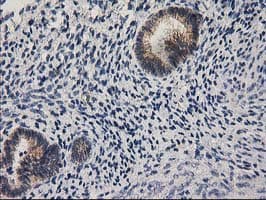 Monoclonal Mouse anti-Human EIF4E2 / IF4e Antibody (clone OTI1F2, IHC, WB)