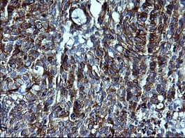CDH3 / P-Cadherin Antibody (clone 2D5, Carrier-free)