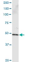 Monoclonal Mouse anti-Human PPP2R2B Antibody (clone 1B10)