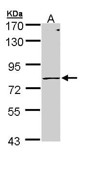 Polyclonal Rabbit anti-Human PIGR Antibody (aa180-459, IHC, WB)