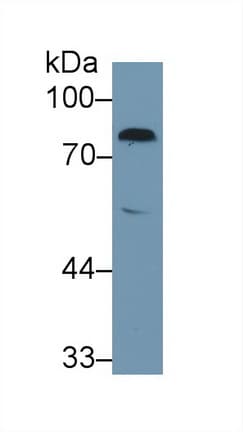 F2 / Prothrombin / Thrombin Antibody (aa44-200, Biotin)