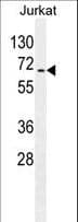 Monoclonal Mouse anti-Human RPS6KB2 / S6K2 Antibody (WB)
