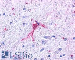 PathPlus™ PAEL Receptor / GPR37 Antibody (N-Terminus)
