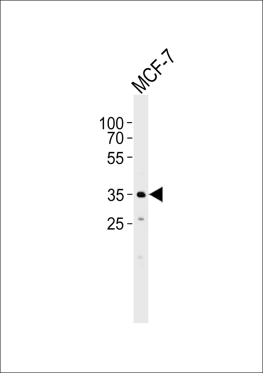 FBXL17 Antibody (aa262-297)