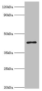 Polyclonal Rabbit anti-Human ACAA1 Antibody (aa27-300, WB)