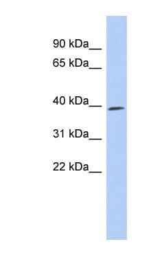 CDK7 Antibody (C-Terminus)